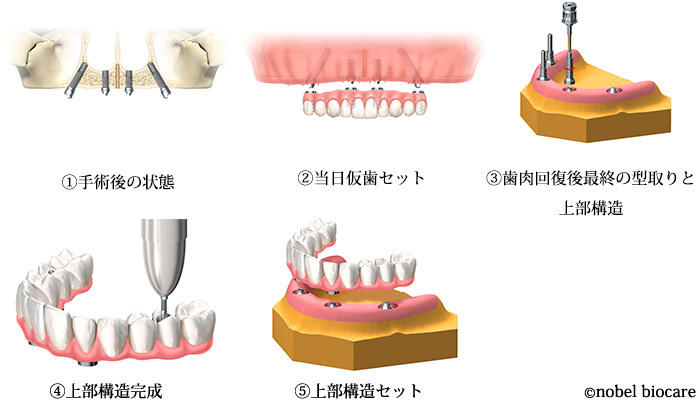 20160301.jpg