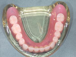 falseteeth_img09.jpg